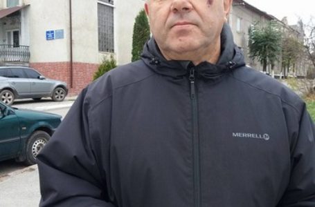 Тернопільський нардеп Олег Барна побив земляка?