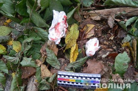 На голову впала суха гілка: травмований мешканець Бережанщини у важкому стані