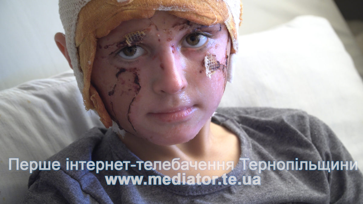 «Допомагали хворим дітям, а нажились шахраї». Мама обпеченого хлопчика у розпачі (Відео)