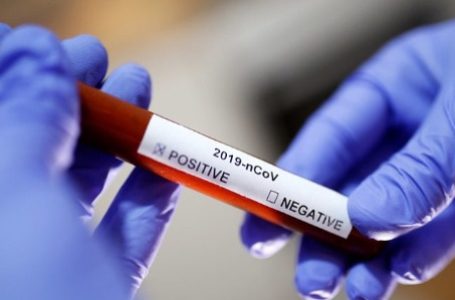 У ще одного жителя Тернопільщини виявили COVID-19