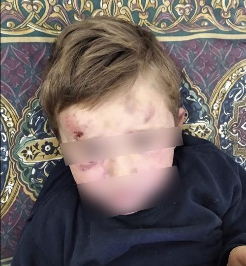 На Тернопільщині чоловік ледь не вбив 4-річного пасинка, бо той не слухався